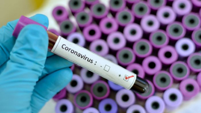 376 са новите случаи на коронавирус у нас
